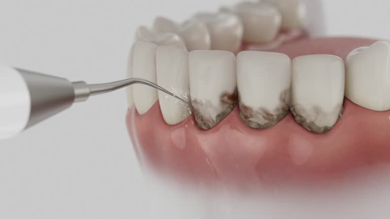 Reliable Dental Implants contractor in Vineyards, FL by Smile Center Dentistry